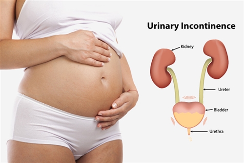 Urinary-Incontinence-During-Pregnancy.jpg