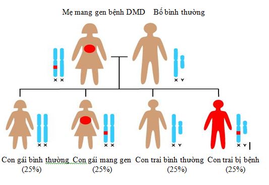 Xét nghiệm gen Hemophilia – Bệnh máu khó đông - Bệnh viện Từ Dũ