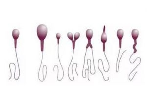 spermiogram.jpg