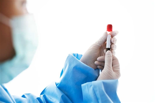 doctor-holding-blood-test-tube.jpg